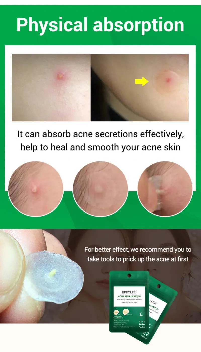 Invisible Skin Treatment Care -Acne Pimple Blemish Removers  Patch Masks